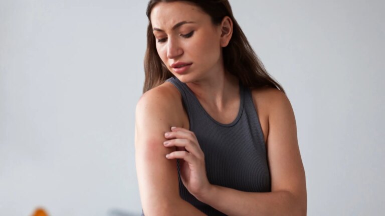 Piqûres de moustiques : signes d’allergie observés chez certaines populations en France.