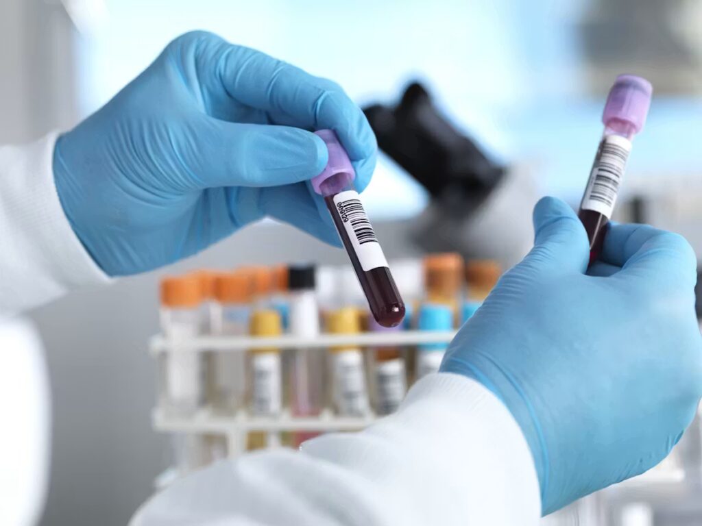 Des chercheurs découvrent des mécanismes biologiques inattendus dans le cancer colorectal