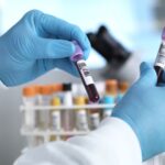 Des chercheurs découvrent des mécanismes biologiques inattendus dans le cancer colorectal