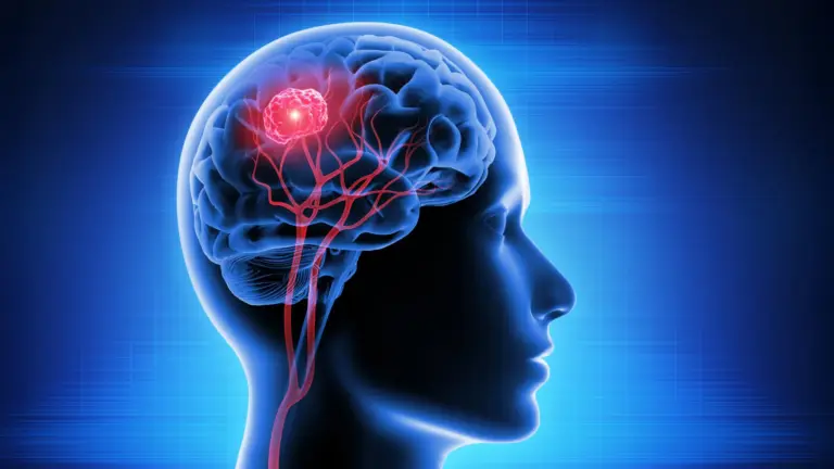 Une nouvelle thérapie à la vitamine B12 montre des résultats prometteurs contre le cancer du cerveau.
