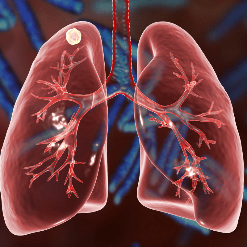 Un peptide des abysses pourrait améliorer le traitement des infections pulmonaires liées à la mucoviscidose.
