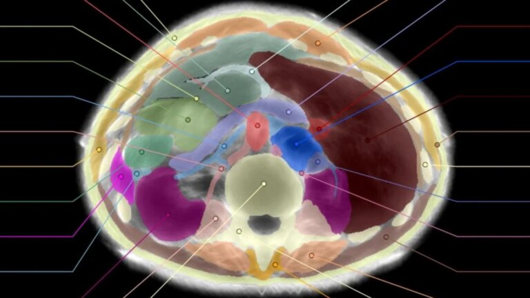 Midjourney dévoile un nouveau système d’imagerie médicale : une échographie complète du corps.