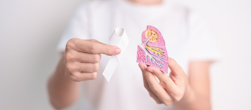 Nouveaux traitements contre le cancer du poumon présentés par l’ASCO 2026.