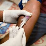 Chlordéconémie : la Haute Autorité de Santé évalue la pertinence du dosage et sa prise en charge.