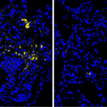 Un acide aminé pourrait réduire le risque de cancer colorectal et d&rsquo;infections.