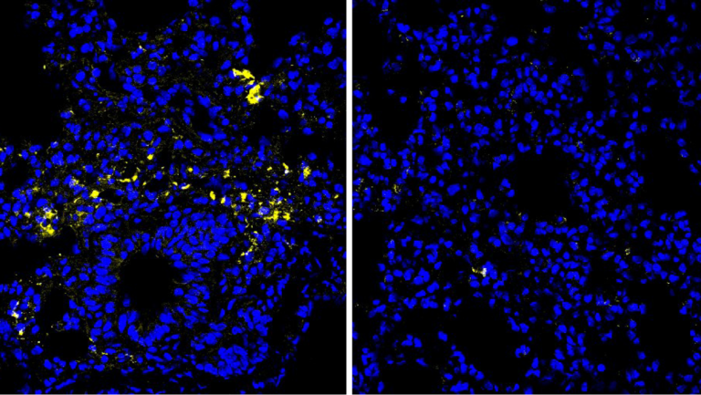 Un acide aminé pourrait réduire le risque de cancer colorectal et d’infections.