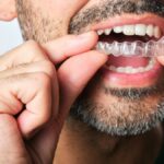 Orthodontie : maintenir l’appareil de contention est essentiel pour éviter des complications.