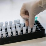 L’Académie de médecine préconise l’autorisation des dépistages génétiques préconceptionnels.