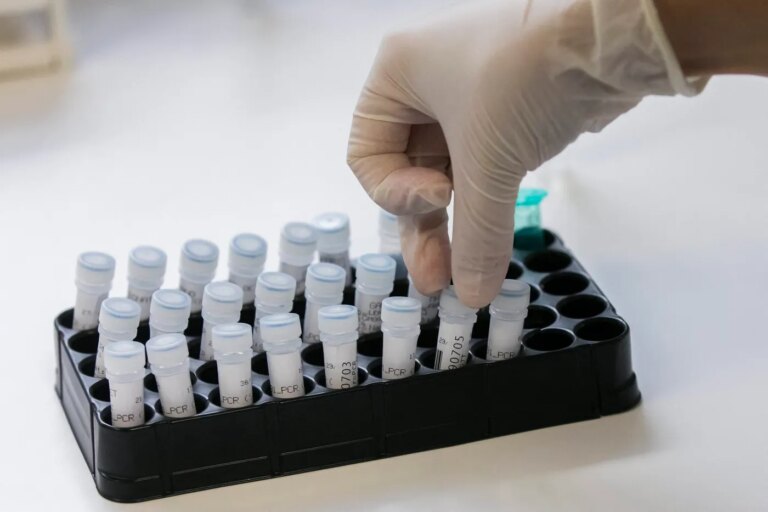 L’Académie de médecine préconise l’autorisation des dépistages génétiques préconceptionnels.