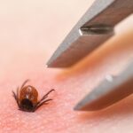 Comment retirer une tique efficacement selon les recommandations de santé publique en France