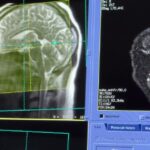 Le CHU de Nice acquiert une nouvelle IRM pour améliorer le diagnostic des pathologies cérébrales.