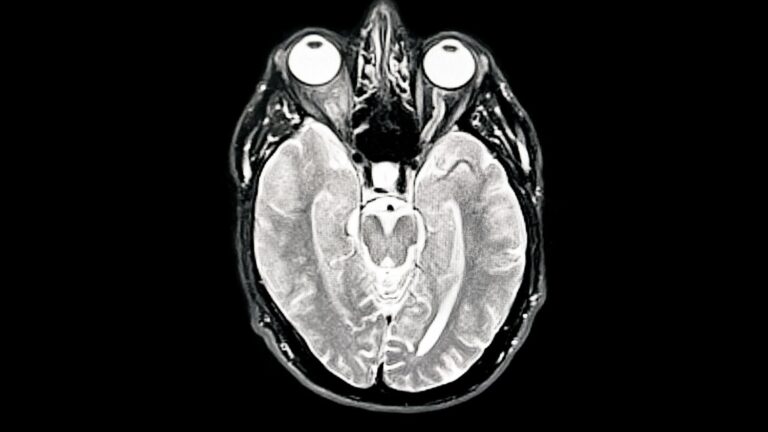 Des scientifiques japonais identifient une substance potentiellement liée à la maladie d’Alzheimer.