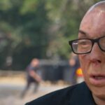 Un pompier français raconte son expérience après avoir survécu à un incendie mortel