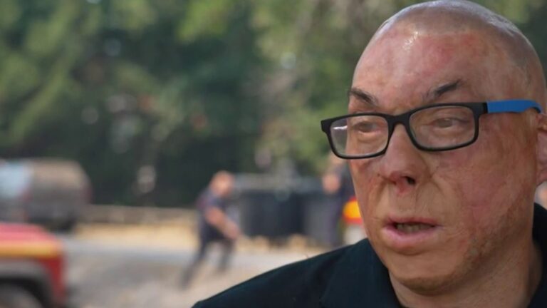 Un pompier français raconte son expérience après avoir survécu à un incendie mortel
