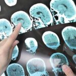 Erreur de diagnostic : un médecin condamné par le Tribunal fédéral suisse
