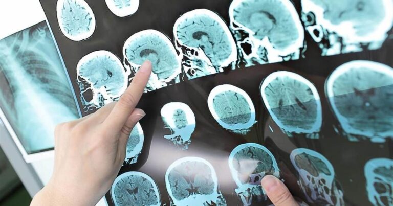 Erreur de diagnostic : un médecin condamné par le Tribunal fédéral suisse