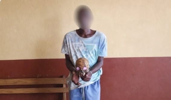 Démantèlement d’un trafic d’ossements humains à Oyem, deux suspects arrêtés.