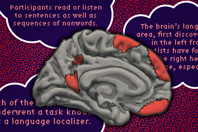Le réseau linguistique du cerveau est plus vaste que les recherches antérieures ne l’indiquaient.