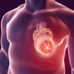 Recherche sur les maladies cardiométaboliques à Lille : résultats d’études récentes dévoilés.
