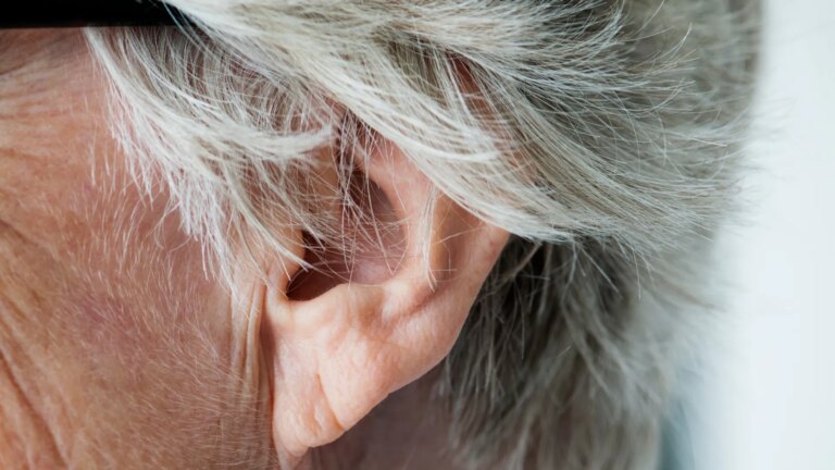 Une forme d’oreille inhabituelle pourrait révéler des liens avec l’évolution humaine.