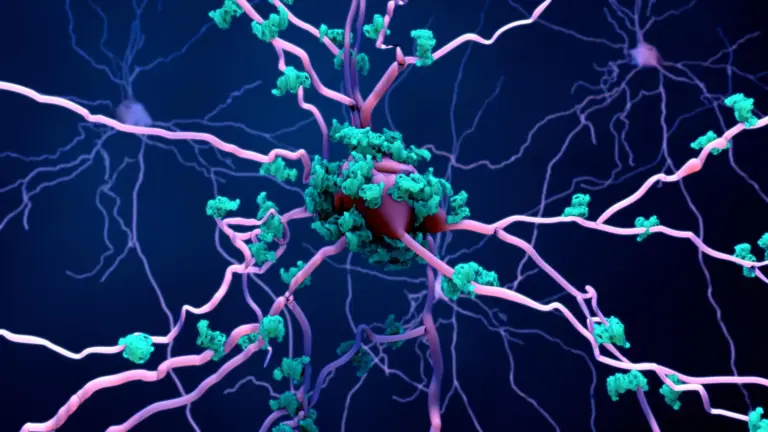 Des chercheurs identifient un mécanisme de destruction des cellules cérébrales dans Alzheimer.