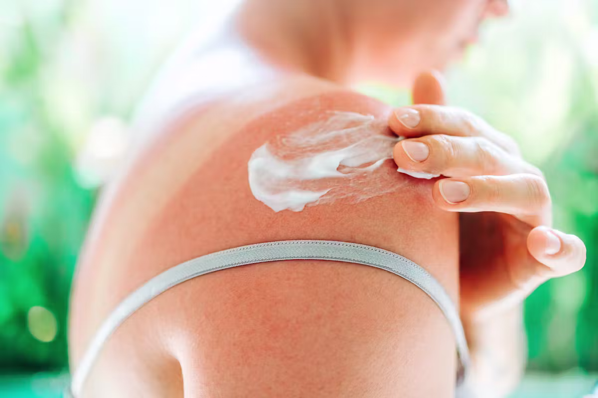 Neuf crèmes solaires sur dix vendues en Chine présentent des risques pour la santé.