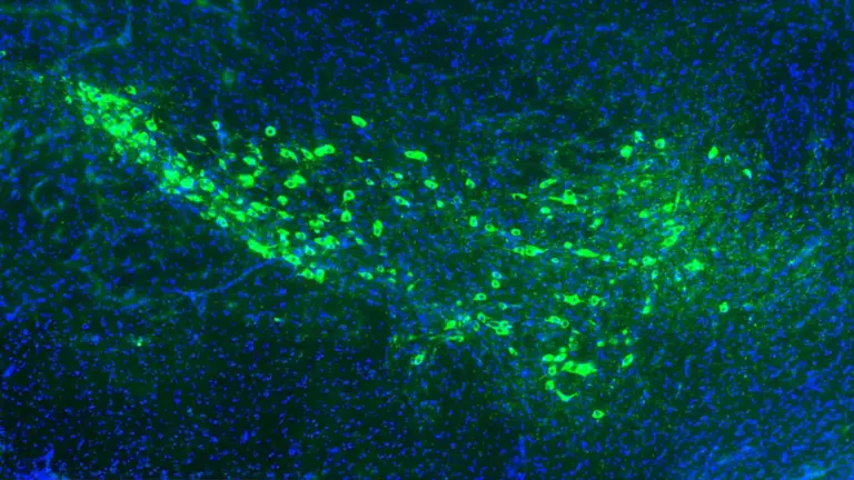 Des chercheurs de Yale identifient un mécanisme de propagation de la maladie de Parkinson dans le cerveau.