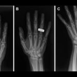 Premières radiographies dans l’espace : espoir pour les patients en route vers la Lune.