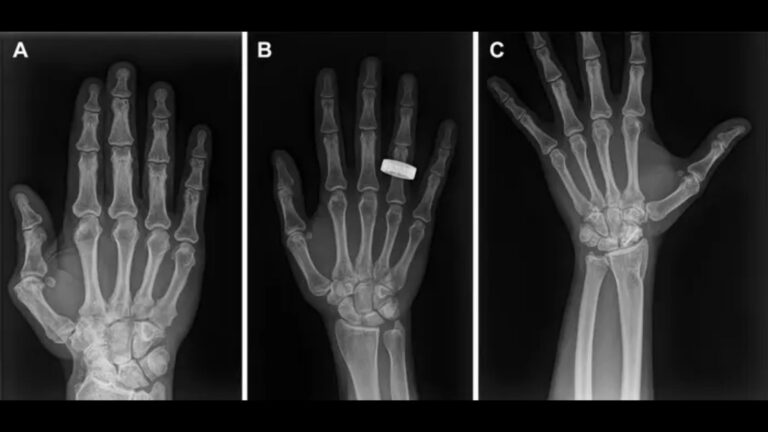 Premières radiographies dans l’espace : espoir pour les patients en route vers la Lune.