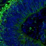 Des cerveaux miniatures cultivés en laboratoire pourraient prédire l&rsquo;efficacité des traitements contre Alzheimer.