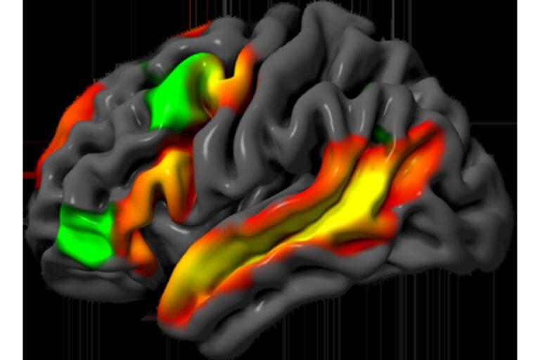 MIT étudie la séparation entre la logique et le langage dans la cognition humaine