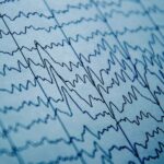 Des champs électriques orientent l’activité neuronale, selon des chercheurs du MIT.