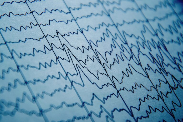Des champs électriques orientent l’activité neuronale, selon des chercheurs du MIT.