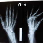 Des astronautes réalisent une radiographie médicale depuis l’espace, ouvrant des perspectives pour Mars.