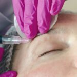Les médecins esthétiques alertent sur les décès liés aux fausses injectrices en France