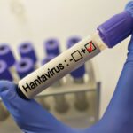 Touriste positif au Hantavirus Andes après un passage en France, alerte sanitaire en cours.