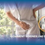 Cystite : symptômes, diagnostic et traitements recommandés par des experts médicaux.