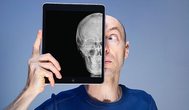 Effet nocebo : des croyances négatives augmentent les symptômes chez les patients.