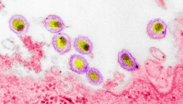 Podcast : Débat sur l’existence du virus du sida dans l’épisode 2 des rumeurs mondiales