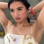 Une femme met en lumière une particularité de peau sous-représentée en France.