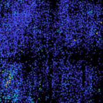 Microscopie à haute vitesse du MIT révèle l’activité électrique dans le cerveau humain