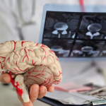 Des scientifiques identifient un germe potentiellement lié à la maladie d&rsquo;Alzheimer.