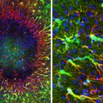 Le cerveau adulte démontre une capacité de réparation supérieure aux attentes scientifiques.
