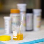 Cystite : fiabilité des autotests urinaires évaluée par des experts en santé publique.