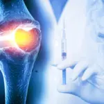 Une injection pourrait prolonger l’efficacité des médicaments contre l’arthrose.