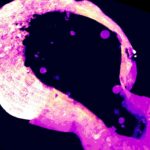Des cellules utilisent une molécule méconnue pour se protéger contre le surcroît de fer.