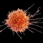 Des cellules tueuses naturelles renforcées offrent une nouvelle approche contre le cancer.