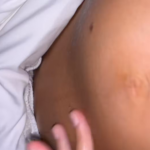 Une femme découvre la forme de son ventre de grossesse et reçoit un diagnostic rassurant.