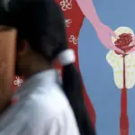 Endométriose et cycles menstruels : nouvelles découvertes sur la biologie de l’utérus