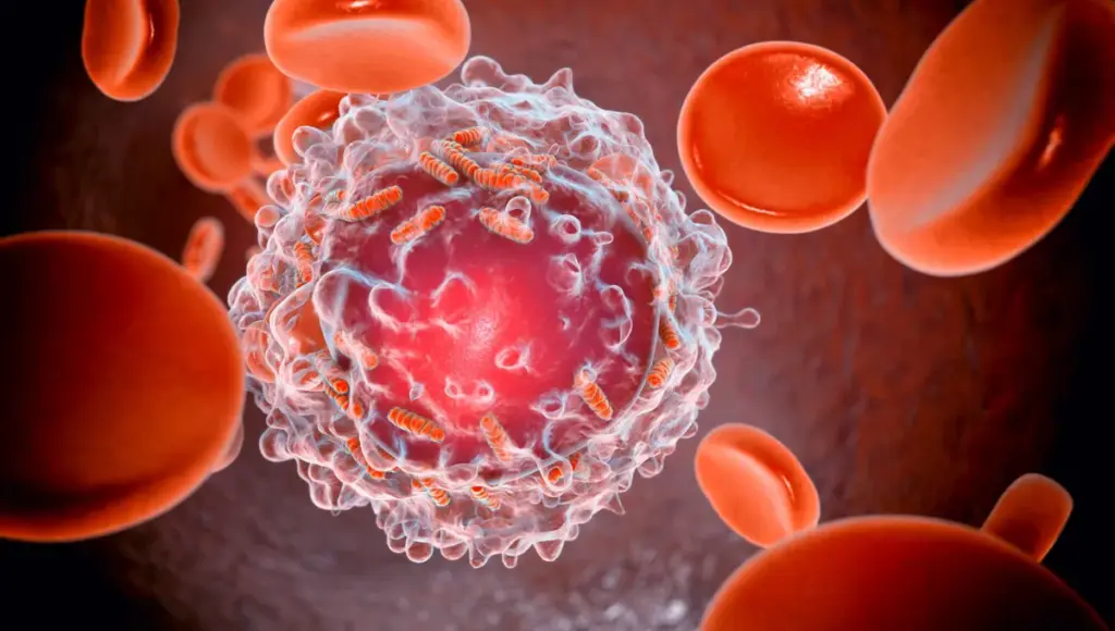 Les cancers du sang en France : diagnostic et traitements en évolution continue